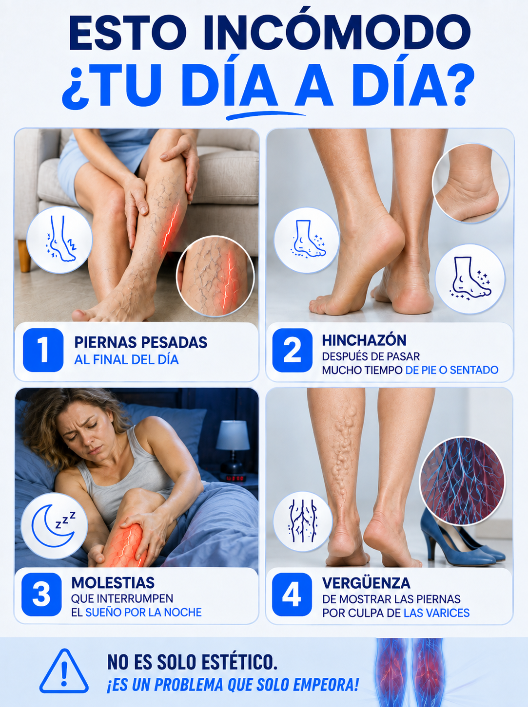 SouthMoon - Spray para varices