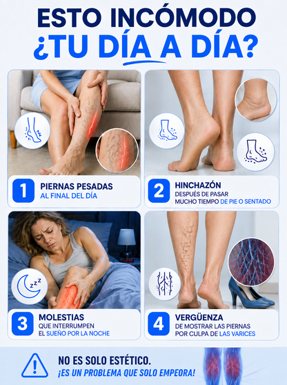 SouthMoon - Spray para varices