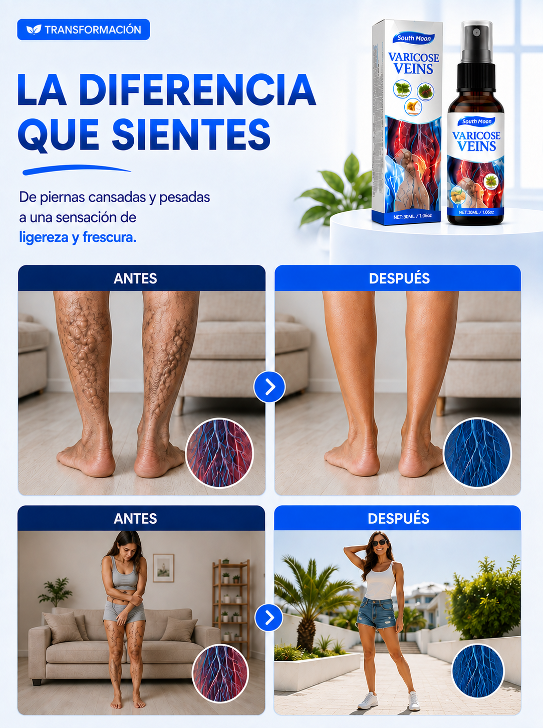SouthMoon - Spray para varices