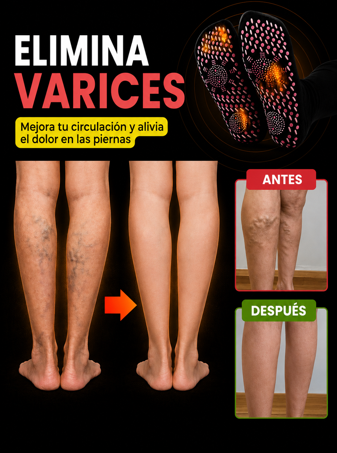 VenaMax™ – Calcetines de Acupresión Anti-Varices