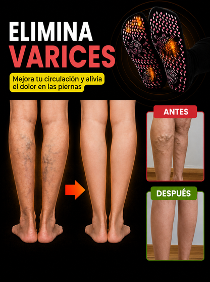 VenaMax™ – Calcetines de Acupresión Anti-Varices