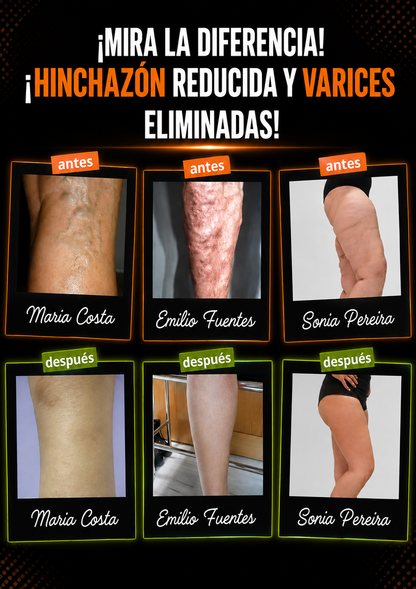 VenaMax™ – Calcetines de Acupresión Anti-Varices